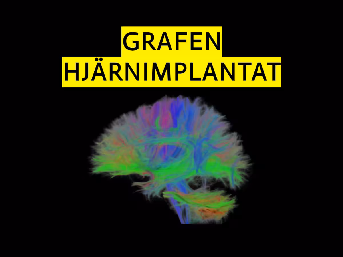 Revolutionerande grafenimplantat banar väg för behandling av neurologiska sjukdomar